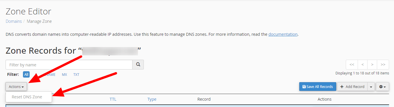 reset dns zone cpanel anymhost